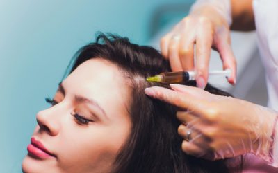 PRP and Hair Loss