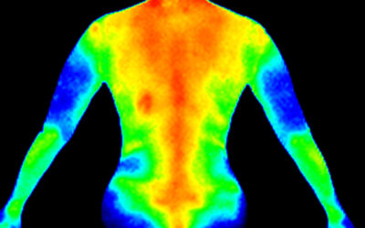 Thermography