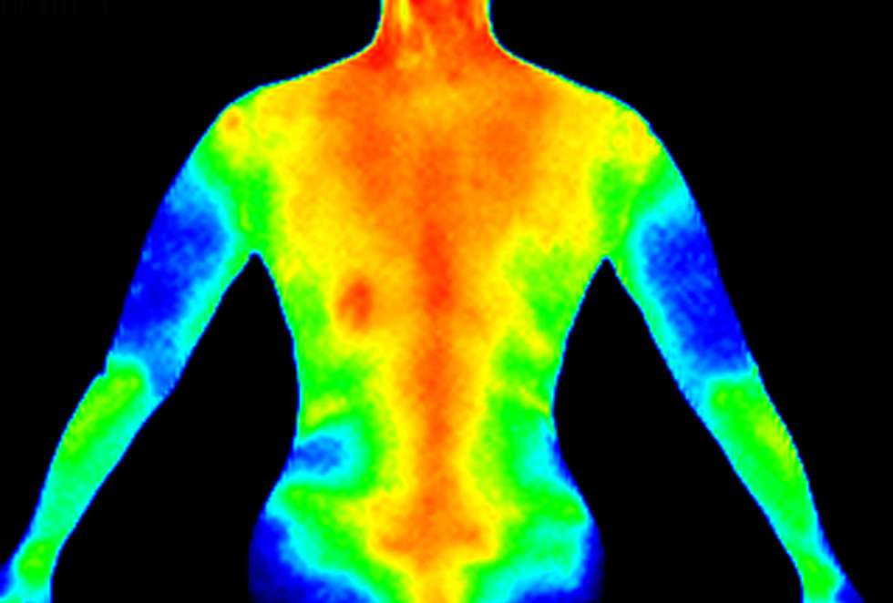 Thermography thermal imaging view of upper body heat patterns for Health Builders patients in Annandale